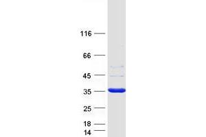 Western Blotting (WB) image for Sulfotransferase Family, Cytosolic, 1A, Phenol-Preferring, Member 1 (SULT1A1) (Transcript Variant 1) protein (Myc-DYKDDDDK Tag) (ABIN2732946)
