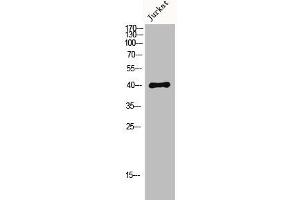 Western Blot analysis of Jurkat cells using MKP-1/2 Polyclonal Antibody (MKP-1/2 抗体)