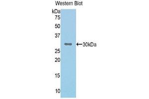 Western Blotting (WB) image for anti-Complement Factor I (CFI) (AA 340-583) antibody (ABIN3205710) (Complement Factor I 抗体  (AA 340-583))
