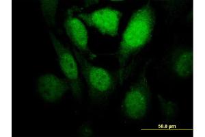 Immunofluorescence of monoclonal antibody to HIPK1 on HeLa cell. (HIPK1 抗体  (AA 330-430))