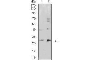 Western Blotting (WB) image for anti-Calbindin 2 (CALB2) (AA 172-271) antibody (ABIN5542429)