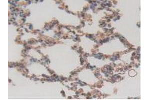 IHC-P analysis of Rat Lung Tissue, with DAB staining. (ITGAD 抗体  (AA 879-1099))