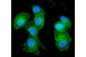 anti-EPH Receptor A2 (EPHA2) (AA 851-970) antibody