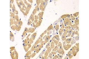 Immunohistochemistry of paraffin-embedded Mouse heart using KYNU Polyclonal Antibody at dilution of 1:100 (40x lens). (KYNU 抗体)