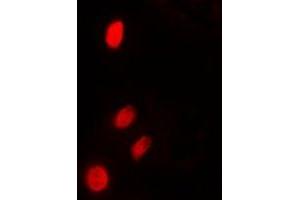 Immunofluorescent analysis of TP53INP2 staining in HeLa cells. (TP53INP2 抗体  (N-Term))