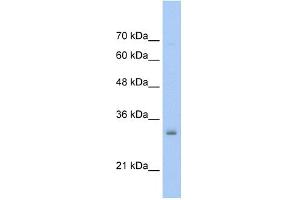 WB Suggested Anti-NSBP1 Antibody Titration:  0. (HMGN5 抗体  (Middle Region))