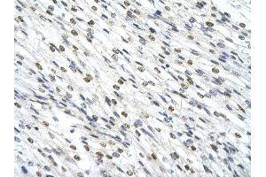 Rabbit Anti-SMARCD2 Antibody       Paraffin Embedded Tissue:  Human cardiac cell   Cellular Data:  Epithelial cells of renal tubule  Antibody Concentration:   4.