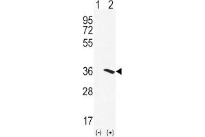 Western Blotting (WB) image for anti-N-Acetyltransferase 2 (Arylamine N-Acetyltransferase) (NAT2) antibody (ABIN3002917) (NAT2 抗体)