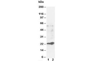 anti-Glutathione S Transferases pi antibody
