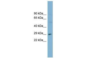 DNASE1 antibody used at 1 ug/ml to detect target protein. (DNASE1 抗体  (N-Term))