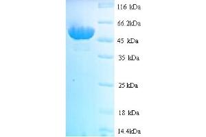 SDS-PAGE (SDS) image for HMT2 (AA 25-459) protein (His tag) (ABIN5714296) (HMT2 (AA 25-459) protein (His tag))