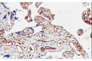 ABIN185194 (2µg/ml) staining of paraffin embedded Human Placenta. (PIK3C2A 抗体  (C-Term))