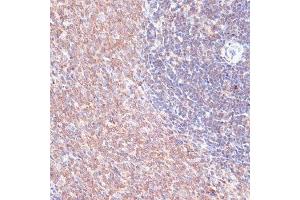 Immunohistochemistry of paraffin-embedded rat spleen using TMX1 antibody  at dilution of 1:100 (40x lens).