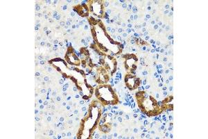 Immunohistochemistry of paraffin-embedded mouse kidney using Calbindin antibody (ABIN7266004) at dilution of 1:100 (40x lens). (CALB1 抗体  (AA 1-261))