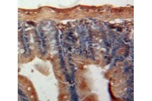 Used in DAB staining on fromalin fixed paraffin-embedded Intestine tissue