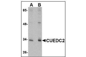 Western blot analysis of CUEDC2 in HeLa cell lysate with CUEDC2 antibody at (A) 1 and (B) 2 µg/ml (CUEDC2 抗体  (C-Term))