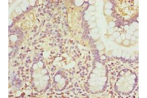Immunohistochemistry of paraffin-embedded human small intestine tissue using ABIN7168034 at dilution of 1:100 (RhoF 抗体  (AA 1-170))