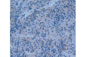 Used in DAB staining on fromalin fixed paraffin- embedded Kidney tissue (PTPRH 抗体  (AA 551-802))