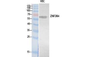 Western Blotting (WB) image for anti-Zinc Finger Protein 384 (ZNF384) (Internal Region) antibody (ABIN3178547) (ZNF384 抗体  (Internal Region))