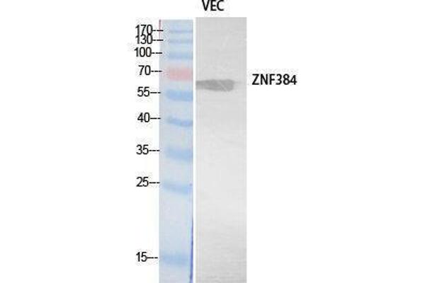 ZNF384 抗体  (Internal Region)