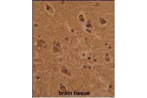 Formalin-fixed and paraffin-embedded human brain tissue with CTDP1 Antibody (N-term), which was peroxidase-conjugated to the secondary antibody, followed by DAB staining. (CTDP1 抗体  (N-Term))