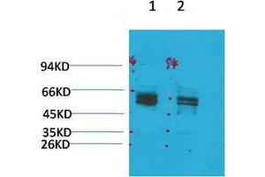 Western Blot (WB) analysis of 1) Rat Brain Tissue, 2)Mouse Brain Tissue with KV11. (KCNH2 抗体)