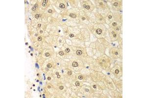 Immunohistochemistry (Paraffin-embedded Sections) (IHC (p)) image for anti-Proteasome (Prosome, Macropain) 26S Subunit, Non-ATPase, 2 (PSMD2) (AA 1-260) antibody (ABIN3015813)