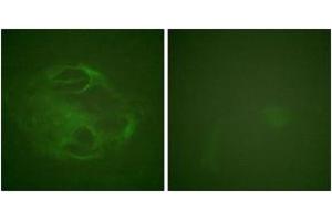 Immunofluorescence (IF) image for anti-Hepatocyte Growth Factor-Regulated tyrosine Kinase Substrate (HGS) (AA 301-350) antibody (ABIN2888879) (HGS 抗体  (AA 301-350))