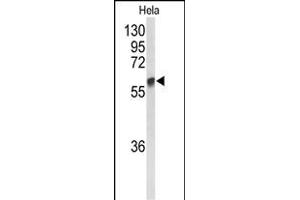 Western blot analysis of GALNT2 Antibody (N-term) (ABIN653281 and ABIN2842795) in Hela cell line lysates (35 μg/lane). (GALNT2 抗体  (N-Term))