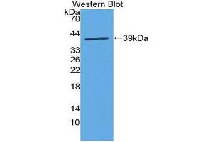 Western Blotting (WB) image for anti-Solute Carrier Family 6 (Neurotransmitter Transporter, Dopamine), Member 3 (SLC6A3) (AA 562-620) antibody (ABIN1867518) (SLC6A3 抗体  (AA 562-620))