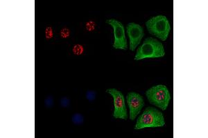 ABIN6256252 and ABIN6267454 staining Hela cells(4h of LPS treatment) by IF/ICC. (MKP1/2 (pSer296), (pSer318) 抗体)