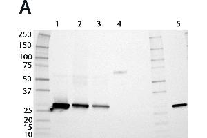 Expression analysis of rat GSTs of the mu and alpha classes. (GSTM1 抗体  (AA 1-218))