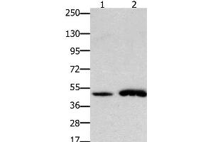 Western Blot analysis of Mouse brain and heart tissue using FOXL2 Polyclonal Antibody at dilution of 1:750 (FOXL2 抗体)