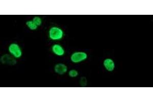 Anti-PPARA mouse monoclonal antibody (ABIN2455018) immunofluorescent staining of COS7 cells transiently transfected by pCMV6-ENTRY PPARA (RC216176). (PPARA 抗体  (AA 145-420))