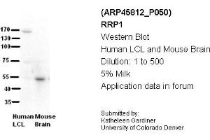 Image no. 2 for anti-Ribosomal RNA Processing 1 Homolog A (RRP1) (C-Term) antibody (ABIN2782369) (RRP1 抗体  (C-Term))