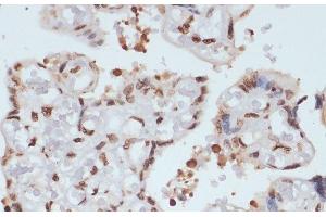 Immunohistochemistry of paraffin-embedded Human placenta using Phospho-CHEK1(S280) Polyclonal Antibody at dilution of 1:100 (40x lens). (CHEK1 抗体  (pSer280))