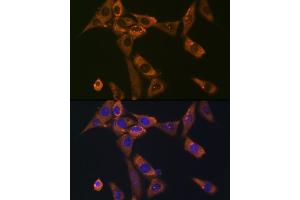 Immunofluorescence analysis of NIH-3T3 cells using Galectin 1/LG Rabbit mAb (ABIN7268197) at dilution of 1:100 (40x lens). (LGALS1/Galectin 1 抗体)