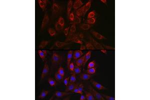Immunofluorescence analysis of NIH/3T3 cells using TGF beta 1 antibody (ABIN7270909) at dilution of 1:150. (TGFB1 抗体  (AA 30-278))