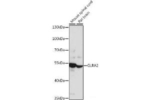Western blot analysis of extracts of various cell lines using GLRA2 Polyclonal Antibody at dilution of 1:1000. (GLRa2 抗体)