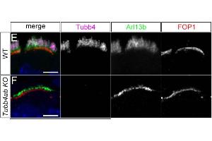 Adult rat hippocampus immunohistochemstry.
