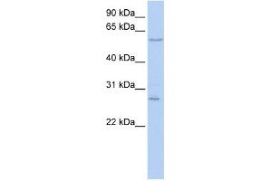 Neuropilin antibody used at 1 ug/ml to detect target protein. (Neuropilin 1 抗体  (N-Term))