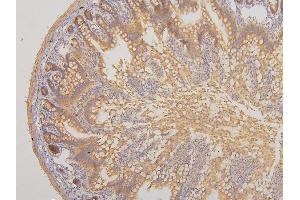 IHC analysis of RAB3GAP2 using anti-RAB3GAP2 antibody (ABIN6719633). (RAB3GAP2 抗体  (AA 1-115))