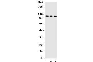 Western blot testing of ADAMTS1 antibody;  Lane 1: rat liver;  2: (r) heart;  3: (r) brain tissue lysate. (ADAMTS1 抗体  (AA 956-968))