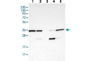 Western blot analysis of Lane 1: RT-4, Lane 2: U-251 MG, Lane 3: Human Plasma, Lane 4: Liver, Lane 5: Tonsil with C7orf20 polyclonal antibody . (Chromosome 7 Open Reading Frame 20 (C7orf20) 抗体)