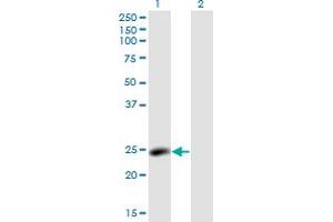 Western Blot analysis of LYPLA2 expression in transfected 293T cell line by LYPLA2 monoclonal antibody (M01), clone 3H5. (LYPLA2 抗体  (AA 144-231))