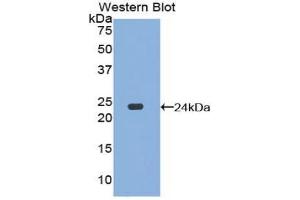 Western blot analysis of the recombinant protein. (DVL1 抗体  (AA 150-332))
