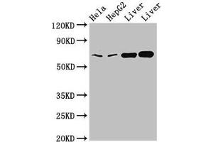 Western Blot Positive WB detected in: Hela whole cell lysate, HepG2 whole cell lysate, Rat liver tissue, Mouse liver tissue All lanes: CLINT1 antibody at 2 μg/mL Secondary Goat polyclonal to rabbit IgG at 1/50000 dilution Predicted band size: 69, 71 kDa Observed band size: 69 kDa (CLINT1 抗体  (AA 1-625))