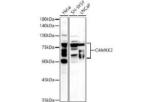 Western blot analysis of extracts of various cell lines, using C antibody (ABIN6130036, ABIN6137894, ABIN6137895 and ABIN6225248) at 1:500 dilution. (CAMKK2 抗体  (AA 1-140))