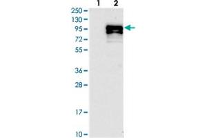 Western blot analysis of Lane 1: Negative control (vector only transfected HEK293T lysate), Lane 2: Over-expression Lysate (Co-expressed with a C-terminal myc-DDK tag (~3. (CCDC82 抗体)