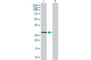 Western Blot analysis of VAPB expression in transfected 293T cell line by VAPB MaxPab polyclonal antibody. (VAPB 抗体  (AA 1-243))